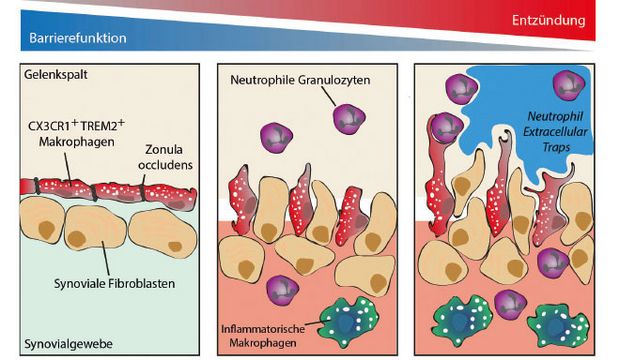 Wie Schutzen Makrophagen Das Gelenk Trillium Gmbh Medizinischer Fachverlag