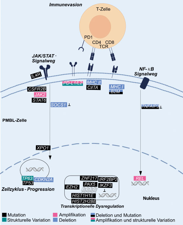 Primär Mediastinales B-Zell-Lymphom – Pathogenese, Diagnostik Und Therapie