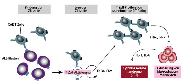 CAR-T-Zellen – Eine Neue Option In Der Hämatologie Und Onkologie